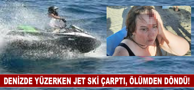 Denizde yüzerken Jet ski çarptı, ölümden döndü